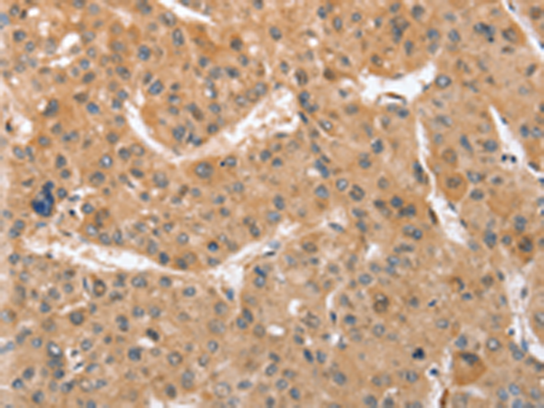 Rabbit Polyclonal Antibody to ATG12