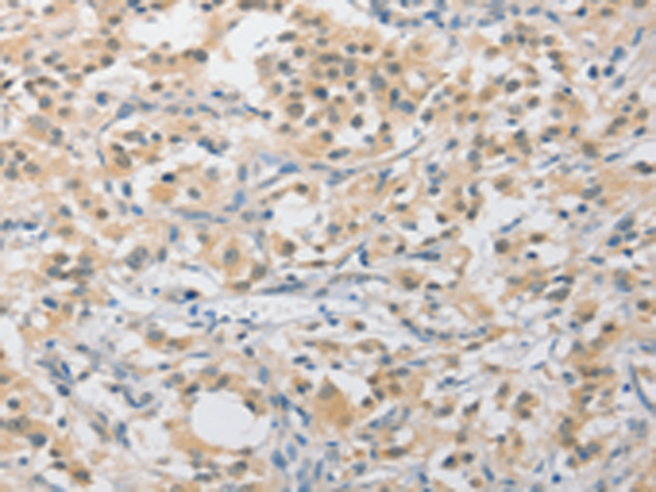 Rabbit Polyclonal Antibody to APLF