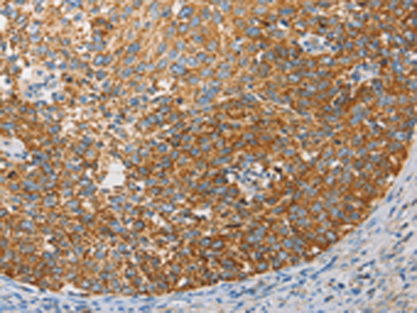 Rabbit Polyclonal Antibody to APOBEC3G
