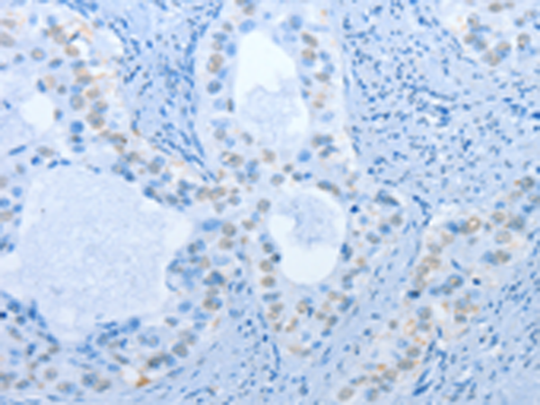 Rabbit Polyclonal Antibody to NAE1