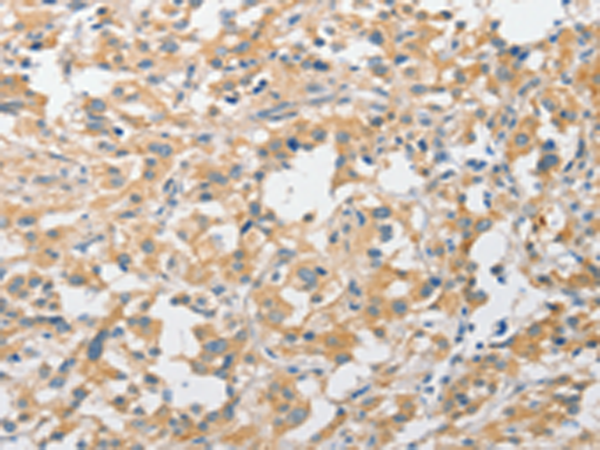 Rabbit Polyclonal Antibody to APPBP2