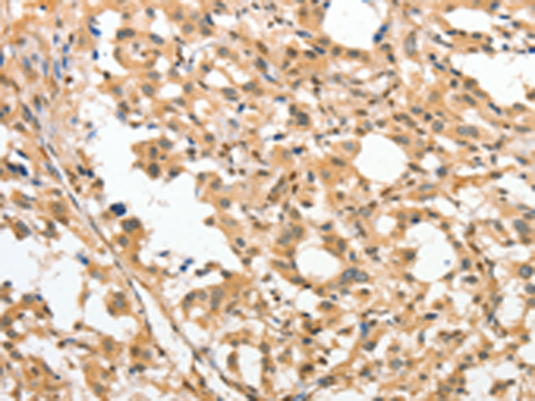 Rabbit Polyclonal Antibody to APTX