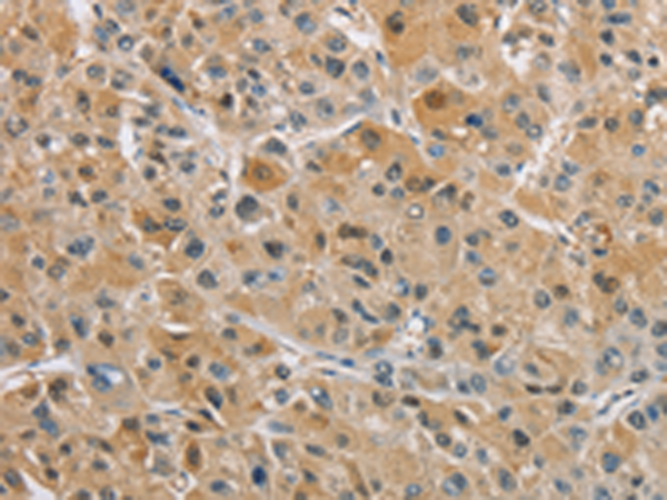Rabbit Polyclonal Antibody to NAPSA