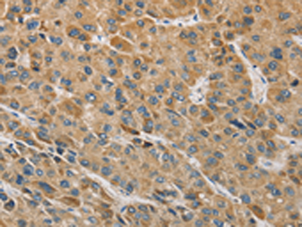 Rabbit Polyclonal Antibody to MIP