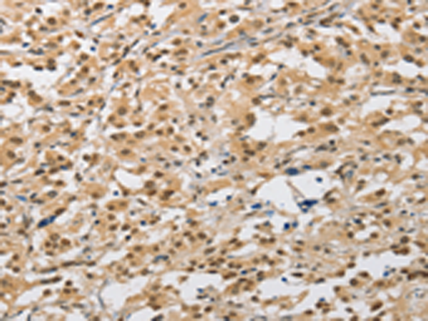 Rabbit Polyclonal Antibody to AMZ2