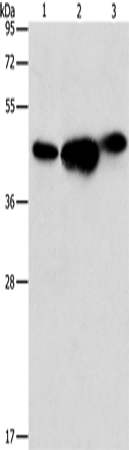 Rabbit Polyclonal Antibody to ARFGAP1