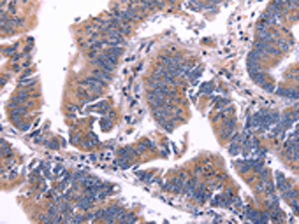 Rabbit Polyclonal Antibody to ARC