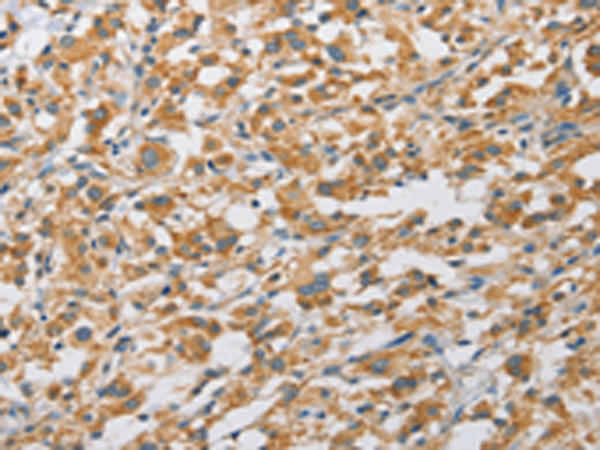 Rabbit Polyclonal Antibody to ARHGAP5