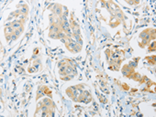 Rabbit Polyclonal Antibody to ARHGEF10