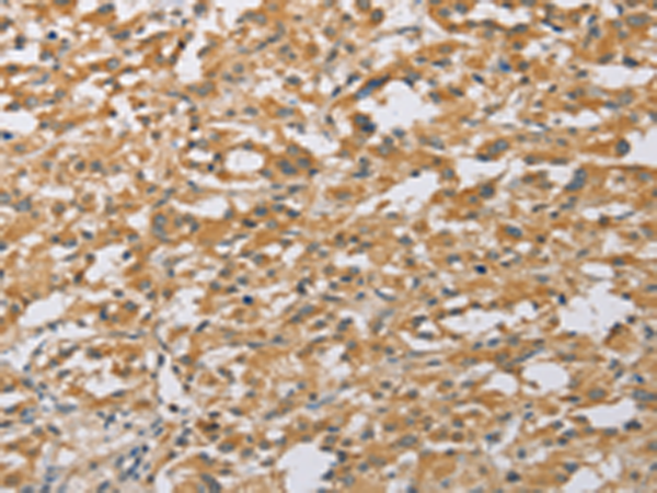 Rabbit Polyclonal Antibody to ARHGEF1