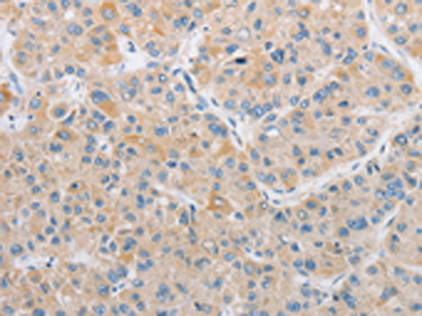 Rabbit Polyclonal Antibody to ARHGEF9