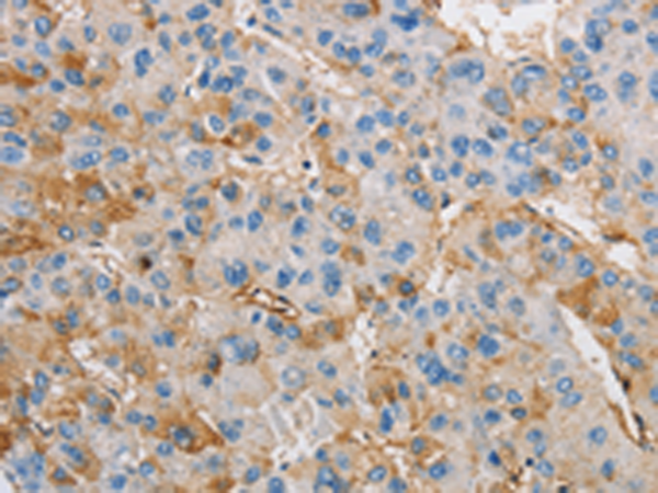 Rabbit Polyclonal Antibody to DIRAS3
