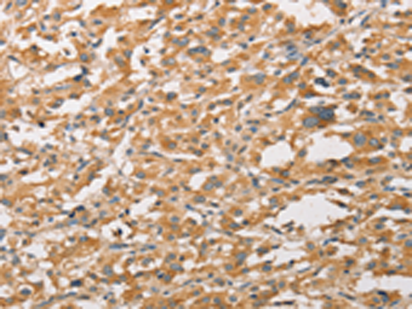 Rabbit Polyclonal Antibody to WNT11