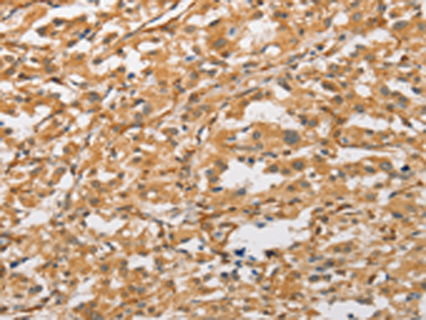 Rabbit Polyclonal Antibody to ARMCX1