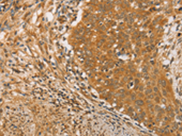 Rabbit Polyclonal Antibody to ARMCX3