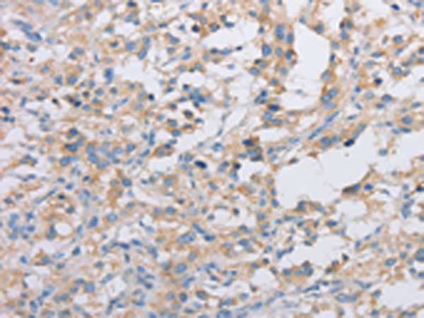 Rabbit Polyclonal Antibody to ACTR2