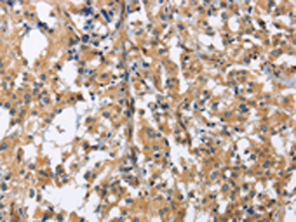 Rabbit Polyclonal Antibody to GAB1