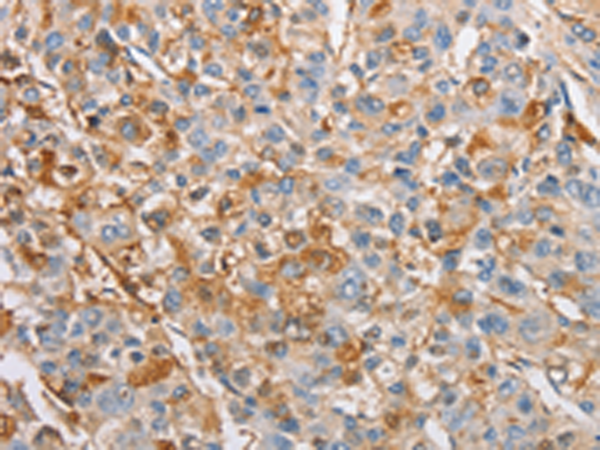 Rabbit Polyclonal Antibody to IKBKG