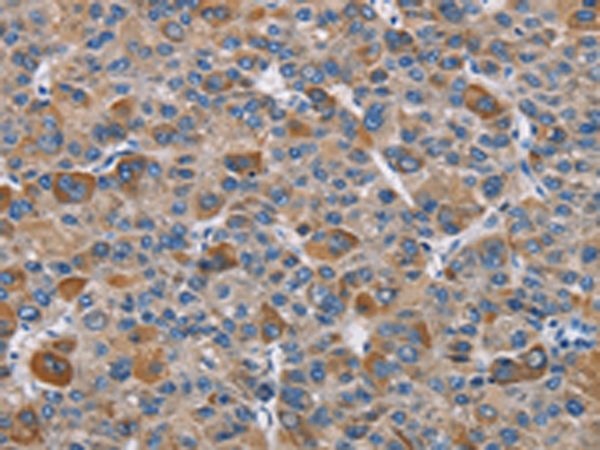Rabbit Polyclonal Antibody to DNMT3A