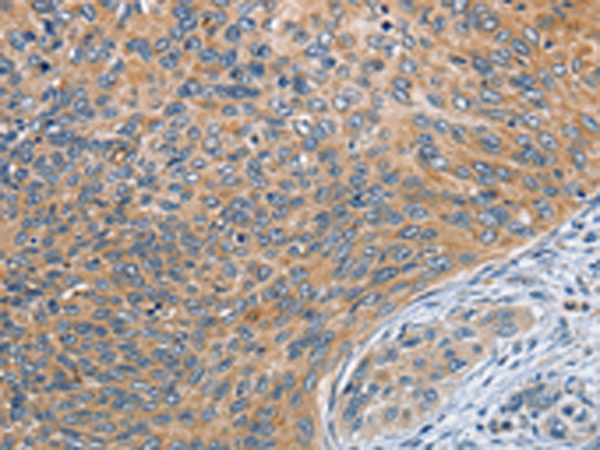 Rabbit Polyclonal Antibody to SPIRE2