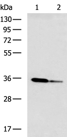 Rabbit Polyclonal Antibody to GNMT