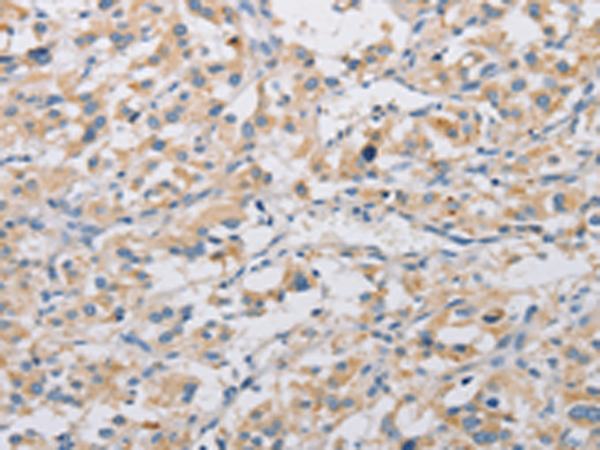 Rabbit Polyclonal Antibody to KAT5