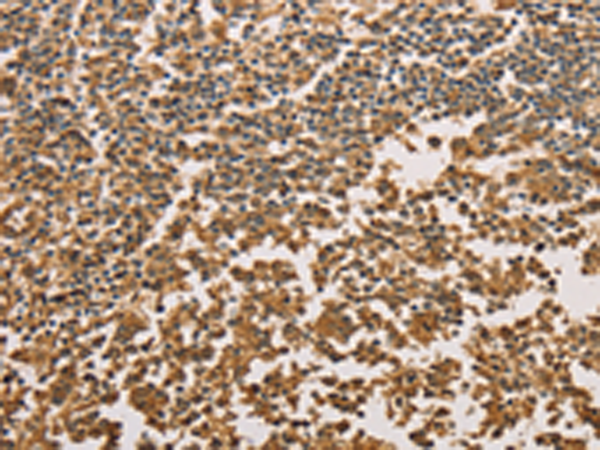 Rabbit Polyclonal Antibody to SETD2