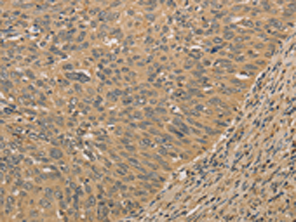 Rabbit Polyclonal Antibody to PRDM14