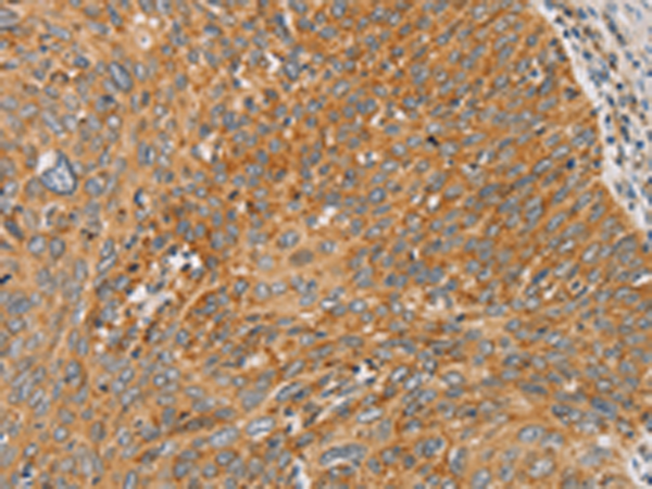 Rabbit Polyclonal Antibody to ARSK