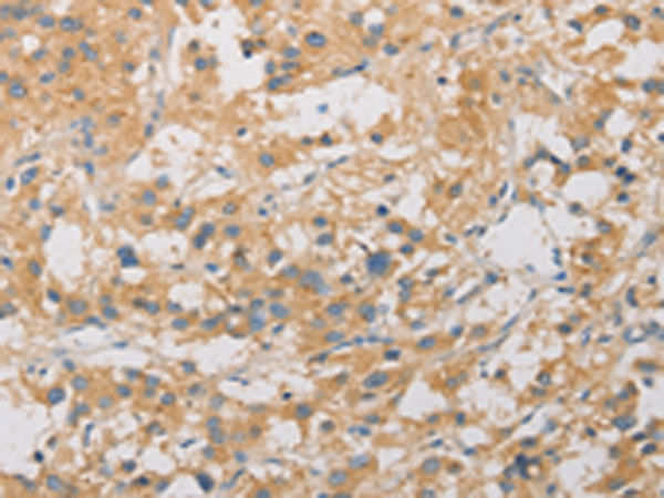 Rabbit Polyclonal Antibody to ARSG