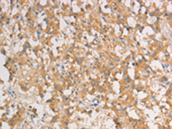 Rabbit Polyclonal Antibody to ART3