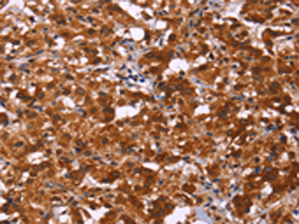 Rabbit Polyclonal Antibody to ART5