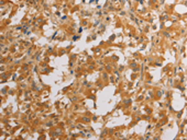 Rabbit Polyclonal Antibody to ATG4D