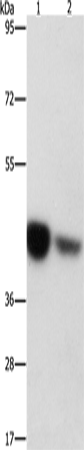 Rabbit Polyclonal Antibody to IDH3G
