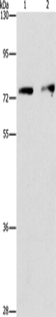 Rabbit Polyclonal Antibody to INTS10