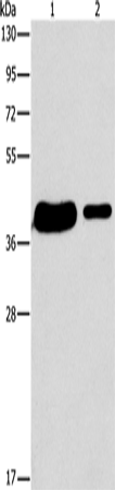 Rabbit Polyclonal Antibody to SAE1