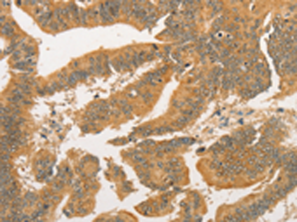 Rabbit Polyclonal Antibody to BCL2L14