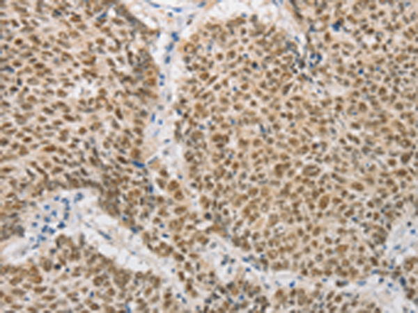 Rabbit Polyclonal Antibody to DNAJB1