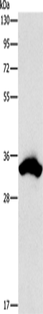 Rabbit Polyclonal Antibody to CDCA8