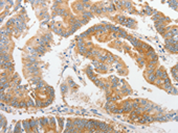 Rabbit Polyclonal Antibody to ALPI