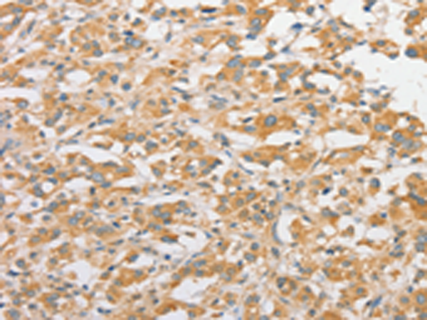 Rabbit Polyclonal Antibody to TLR5
