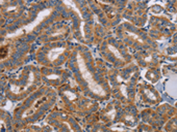 Rabbit Polyclonal Antibody to TLR8