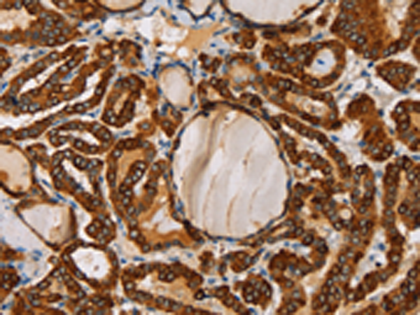 Rabbit Polyclonal Antibody to TLR6