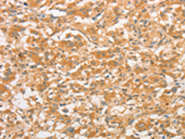 Rabbit Polyclonal Antibody to TLR3