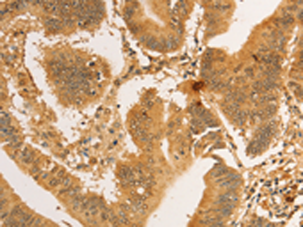 Rabbit Polyclonal Antibody to RPL26L1