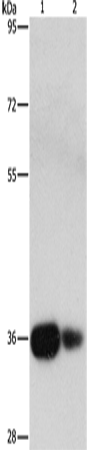 Rabbit Polyclonal Antibody to UCHL5
