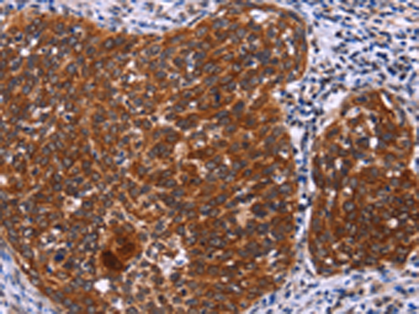 Rabbit Polyclonal Antibody to USP2