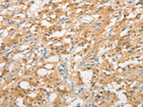 Rabbit Polyclonal Antibody to UBQLN1