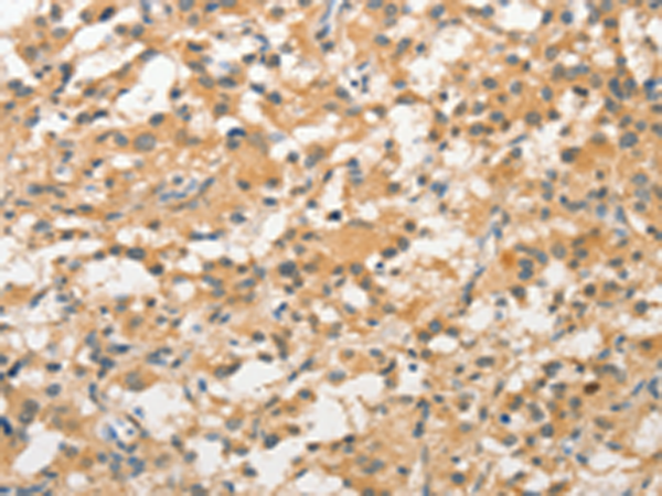Rabbit Polyclonal Antibody to STAM