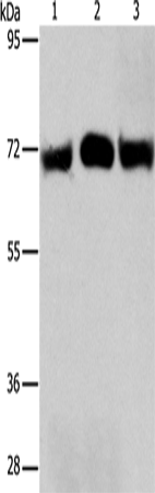 Rabbit Polyclonal Antibody to RPN1
